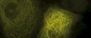 徕卡显微镜TIRF在生命科学研究中的应用
