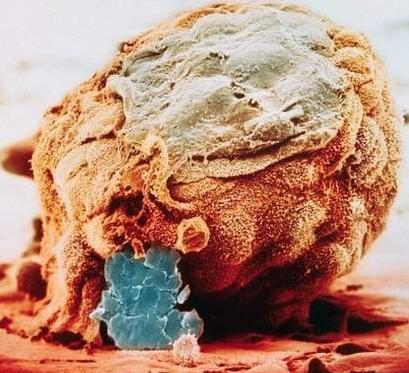 电子显微镜下生命的诞生过程