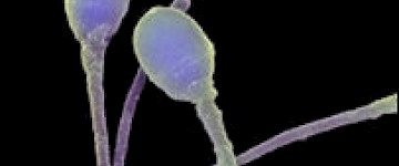 显微镜下的精子图片